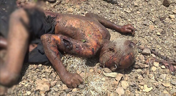 Yemen Can’t Wait: 18 Martyred, Several Injured in a New Saudi Massacre in Taiz [Graphic content]